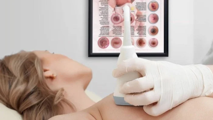 УЗД молочних залоз: важливий крок для збереження жіночого здоров’я