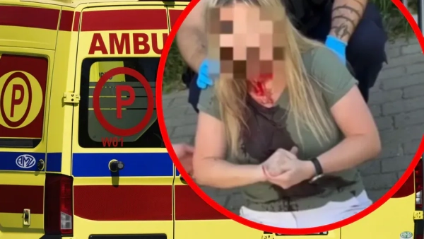 Поліція Ґдині шукає чоловіка, який напав на українку з тростиною